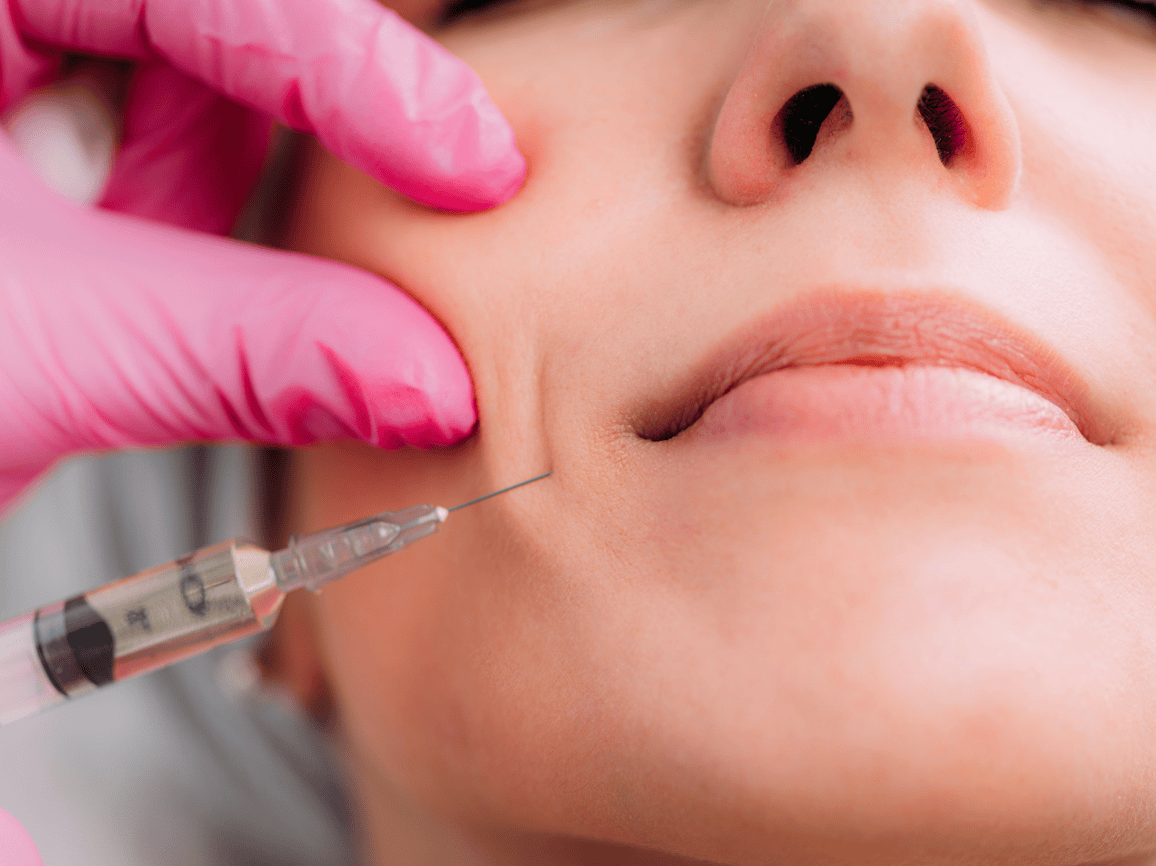 Dermal Fillers