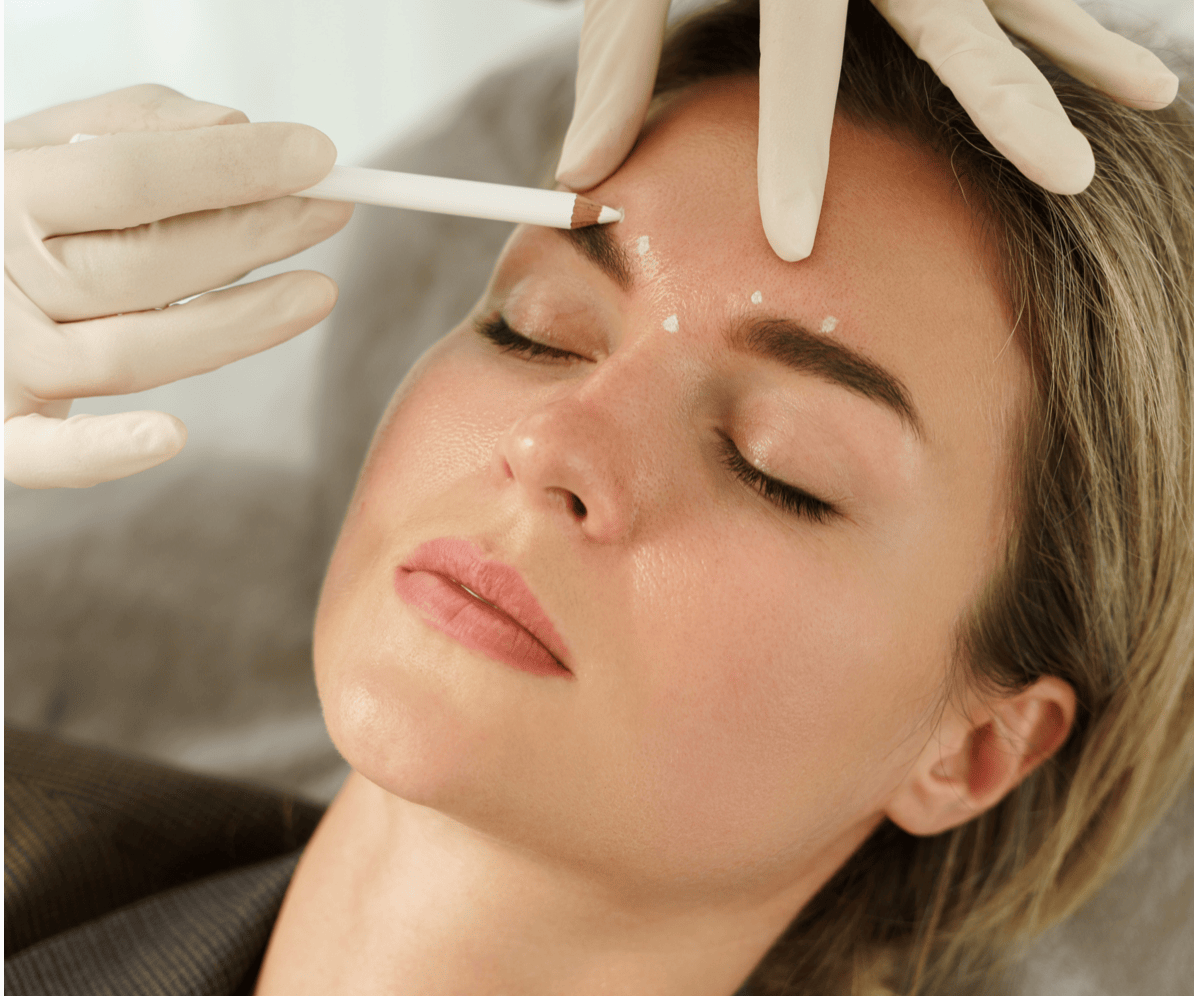 Dermal Fillers