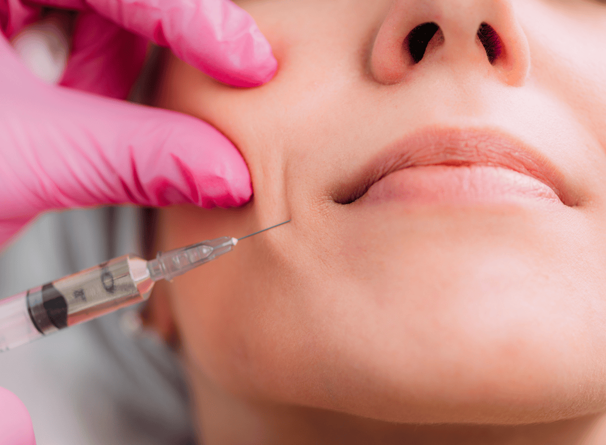 Dermal Fillers