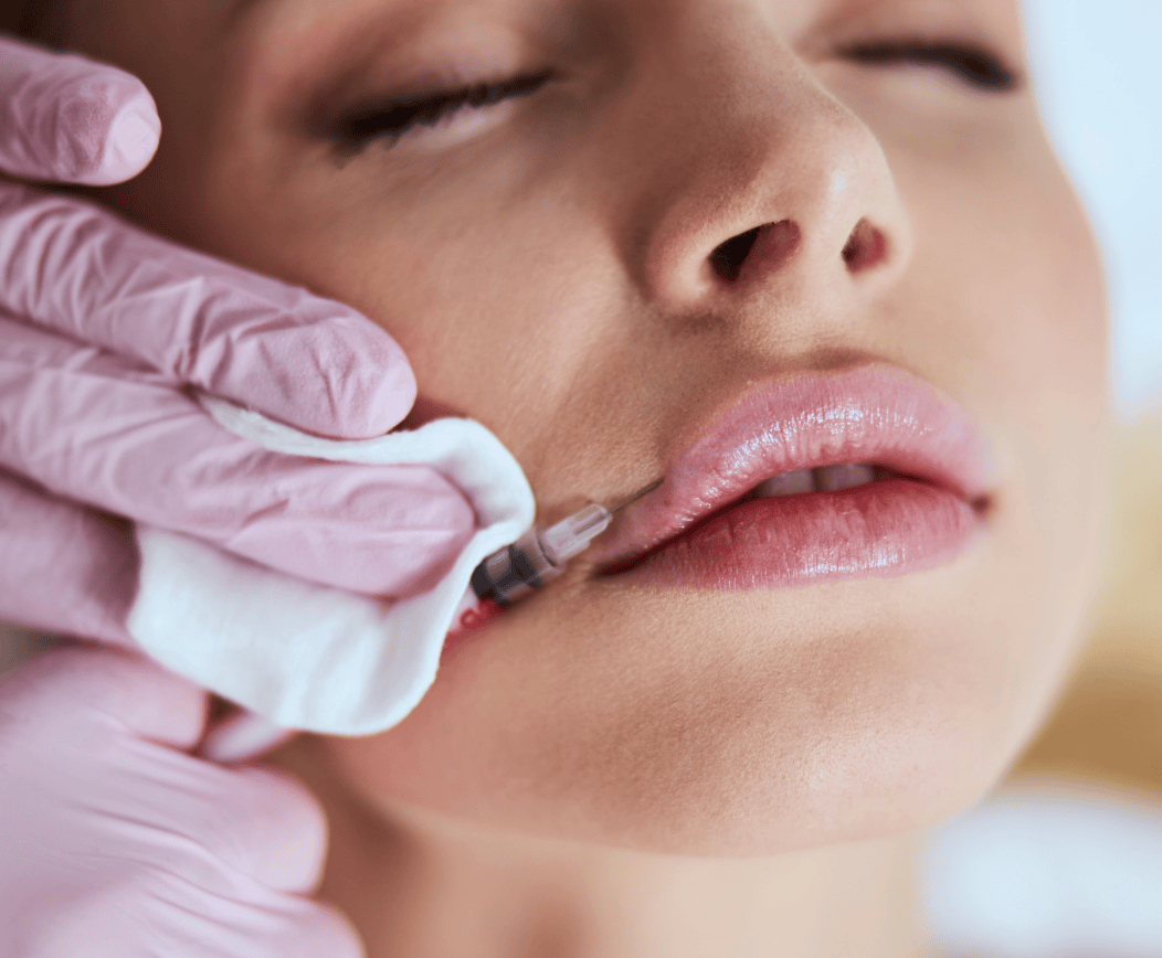 Dermal Fillers